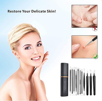 Pimple Popper Tool Kit 11 Pcs, Blackhead Remover Pimple Extractor Tools with Metal Case